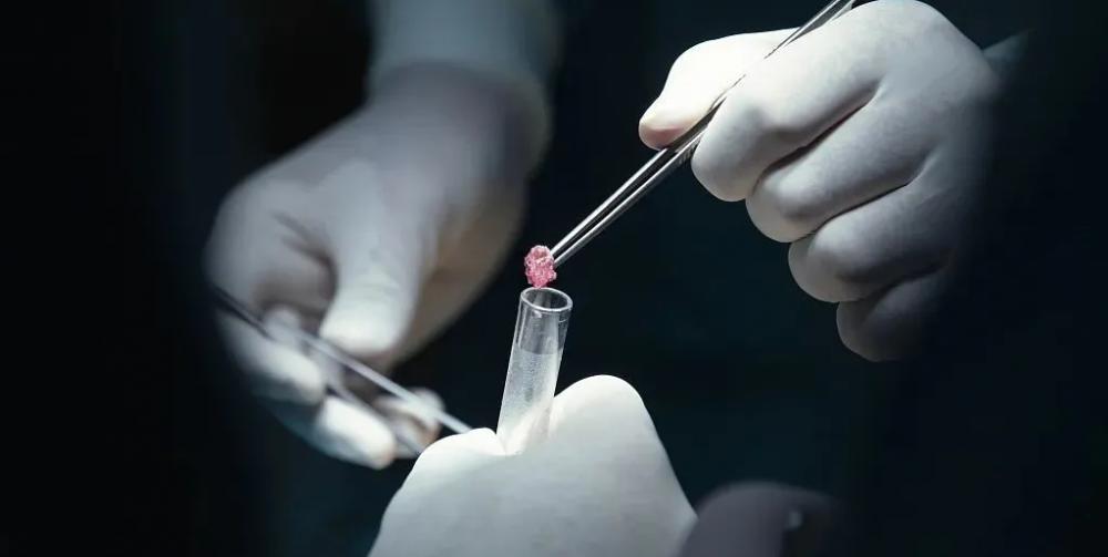 多西他赛化疗价格（乳腺癌全身多发转移）