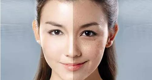激光皮秒价格（皮秒激光祛斑会反黑）