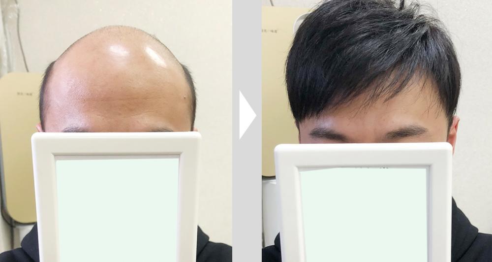 頭發收購尺寸表及價格（定制假發大概多少錢）