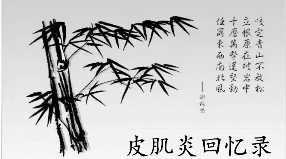 复方甲氧那明胶囊价格（皮肌炎回忆录）