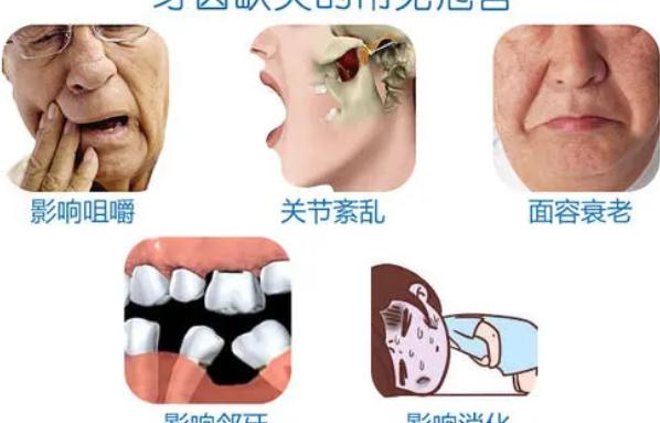 德国种植牙品牌及价格是多少（种植牙怎么选）