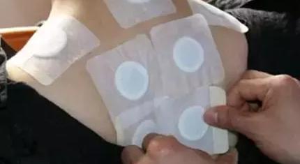 田七消炎镇痛贴价格（腰酸背痛）