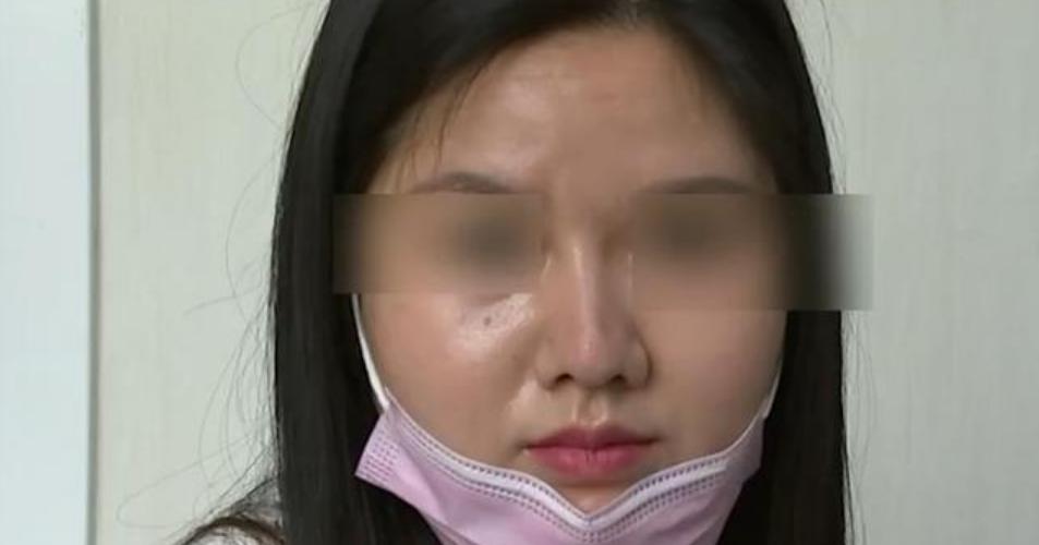 缩小鼻翼鼻头手术多少钱（花4万5整鼻子）