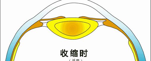 配老花镜多少钱（老花眼是如何配镜的）