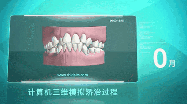 激光美白全身多少钱一次（即日起）