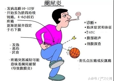阑尾炎微创手术多少钱（面对阑尾炎手术）