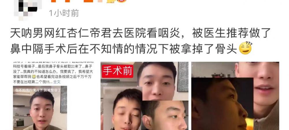 整个鼻多少钱（男网红咽喉不适去医院检查）