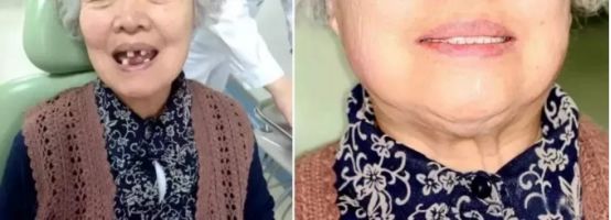 激光美白全身多少钱一次（即日起）