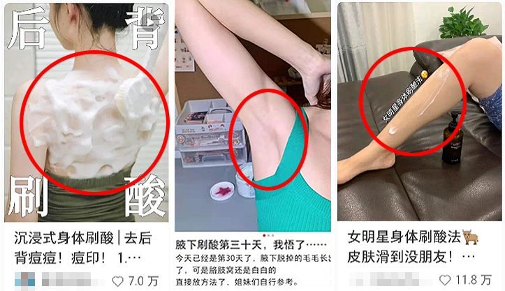 果酸換膚多少錢一次（年輕人的）