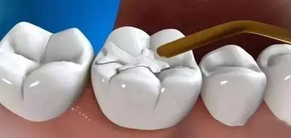 激光美白全身多少钱一次（即日起）