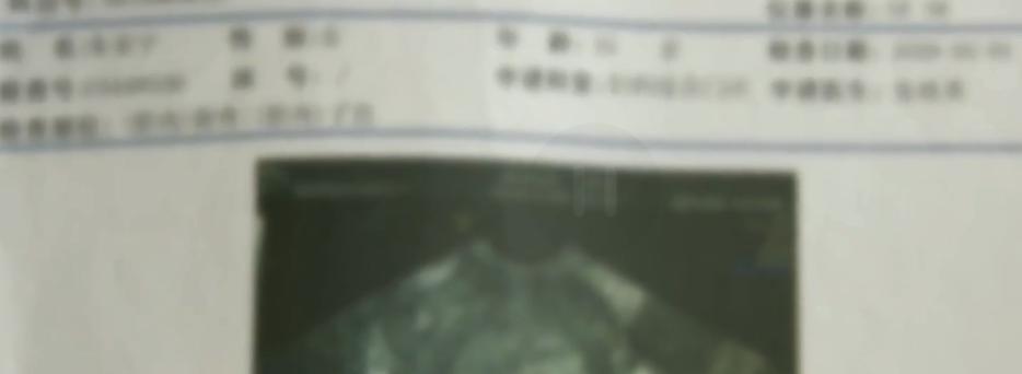 清宫手术要多少钱（保胎不成）