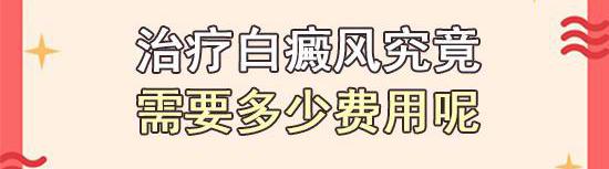 白殿疯治好多少钱（治好白癜风要花多少钱）