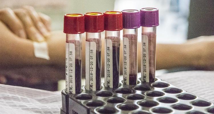 血液净化一次多少钱（5万一次的血液净化能降血脂）