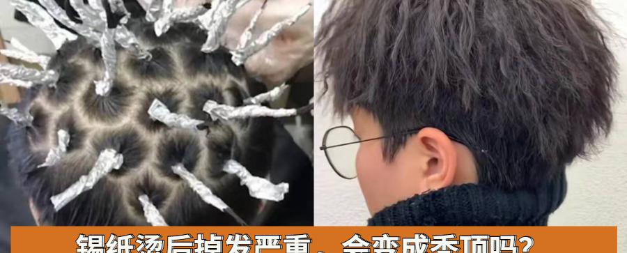 锡纸烫多少钱（烫锡纸烫后掉发严重）