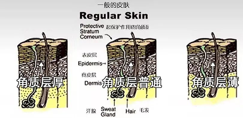 果酸換膚多少錢一次（年輕人的）