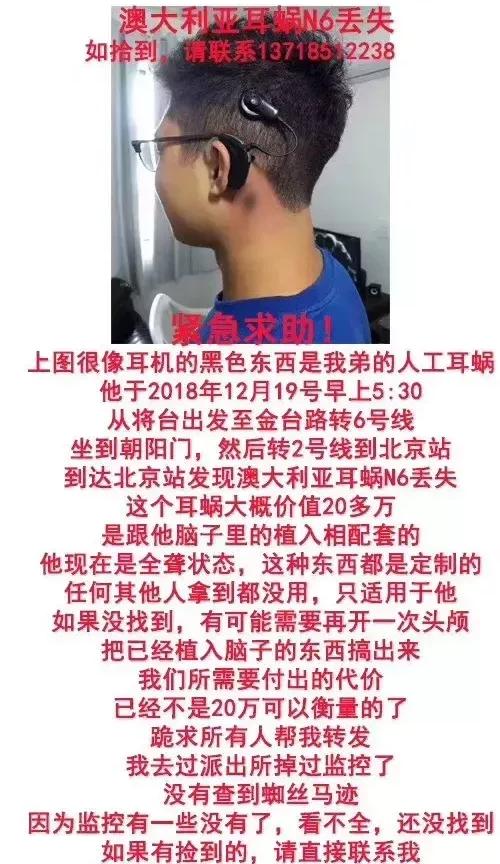 人工耳蜗要多少钱（天价）