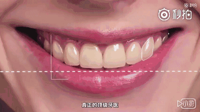 激光美白全身多少钱一次（即日起）