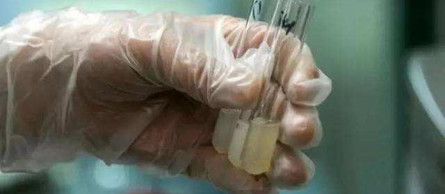 精子检查多少钱一次（上医院做精液检查）