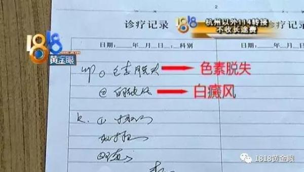 白殿疯确诊要多少钱（两个白点）