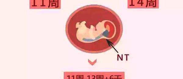 nt檢查要多少錢（孕婦做NT檢查也有技巧）