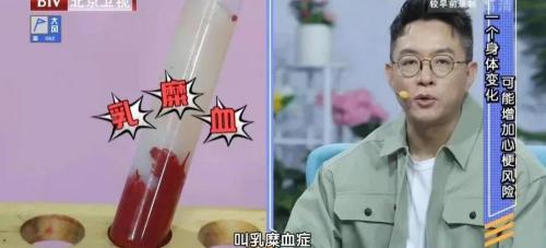 颈动脉彩超检查多少钱（这项指标很多人都不重视）