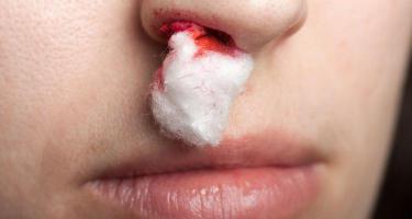 红霉素软膏多少钱（1块钱的红霉素软膏）