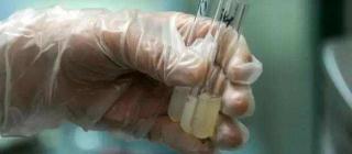 化验精子多少钱一次（上医院做精液检查）