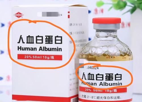 人血白蛋白多少钱一支（白蛋白去药店买）