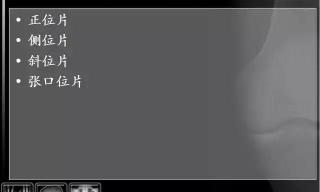 頸椎拍片多少錢(頸椎X光片)
