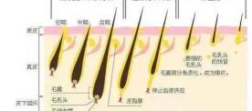 色素沉着用激光多少钱一次（医美脱毛）