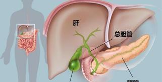 胆囊息肉手术大概需要多少钱（体检查出胆囊息肉）