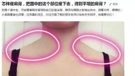 瘦肩针一针大概多少钱（靠瘦肩针治溜肩）