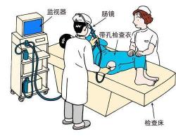 无痛肠镜多少钱（无痛肠镜真的不痛吗）