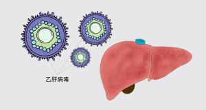 乙肝dna检查要多少钱（乙肝防治进入）