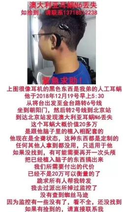 耳蜗多少钱（天价）