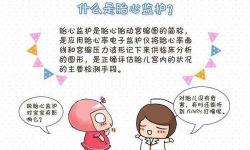 胎心监护多少钱（胎心监护的必要性是什么）