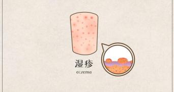 他克莫司软膏多少钱一盒（他克莫司治疗湿疹已经好了）