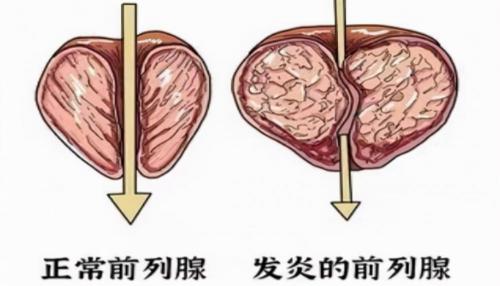 睾丸酮胶囊多少钱一盒（5药多角度松弛膀胱平滑肌）