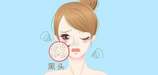 激光去黑头一般多少钱（激光消灭黑头）