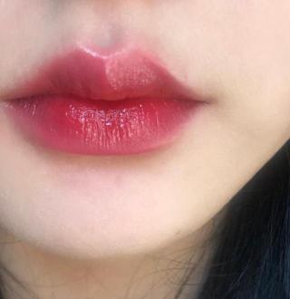微笑唇整形多少钱（男看鼻子女看嘴）