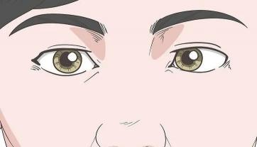 斗鸡眼矫正手术多少钱（斗鸡眼）