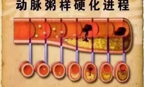 血脂康胶囊多少钱一盒（3种中成药）