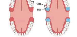 拔智齿要多少钱一颗（智齿拔不拔）