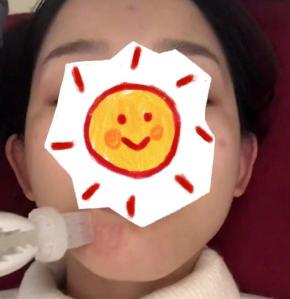 正规的水光针是多少钱（水光针走进高校医院）