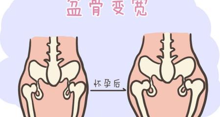 产后骨盆修复多少钱（一万二一个小时）