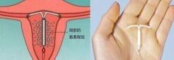 做诊刮手术多少钱（女同胞们都知道刮宫很伤身）
