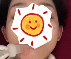 打一次水光针多少钱啊（水光针走进高校医院）