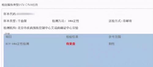 cd4检查多少钱（艾滋病会经历3个阶段）