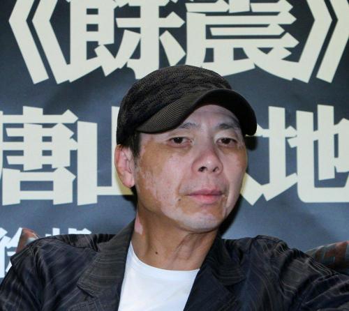 皮肤ct检查多少钱（长白斑就是白癜风）