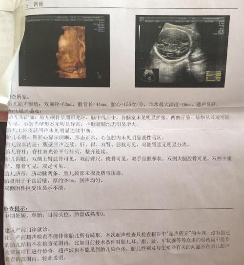 大排畸多少钱（宝爸陪孕日记）